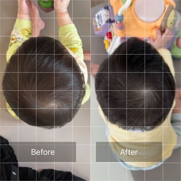 赤ちゃんの頭をまん丸に！AGOセラピストスクールが100名限定で頭の形ケアモニターを募集　沖縄県那覇市で7月22日に開催