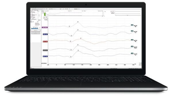 ダイアテックジャパン、補聴器および人工内耳の装用効果を客観的に検証可能な「Aided Cortical：皮質聴覚誘発電位検査」を2025年6月19日(木)より発売