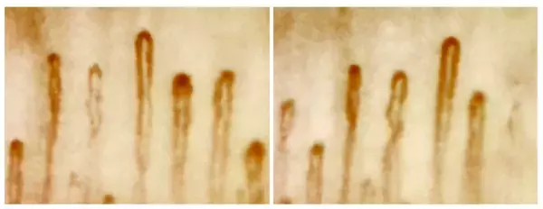 医療機器磁気ネックレス「ANGLE(アングル)」がJLPGA女子プロゴルファー政田夢乃とアンバサダー契約を締結