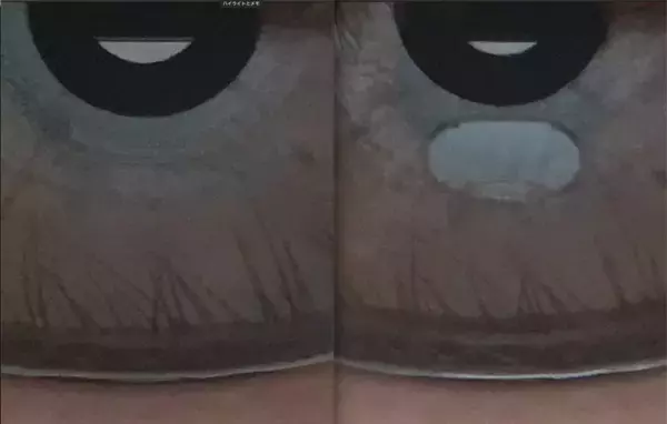 目の健康管理は「測る」から「育てる」へ。AIによる目のセルフチェックアプリ「メニスコープ(TM)」誕生　- 疲れ目・眼精疲労社会に、“日常使いのアイケア”を提案 -