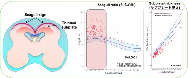 世界初・ダウン症個別化医療の扉を開く胎児脳マーカーを発見　産婦人科学分野の最高峰ジャーナルAJOGに掲載