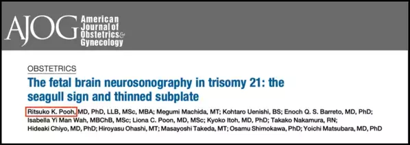 世界初・ダウン症個別化医療の扉を開く胎児脳マーカーを発見　産婦人科学分野の最高峰ジャーナルAJOGに掲載