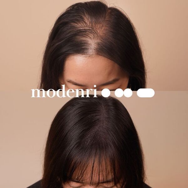 韓国のアートメイク＆スカルプケア専門サロン『モデンリー』2025年9月より本格的な頭皮ケアプログラムを提供開始
