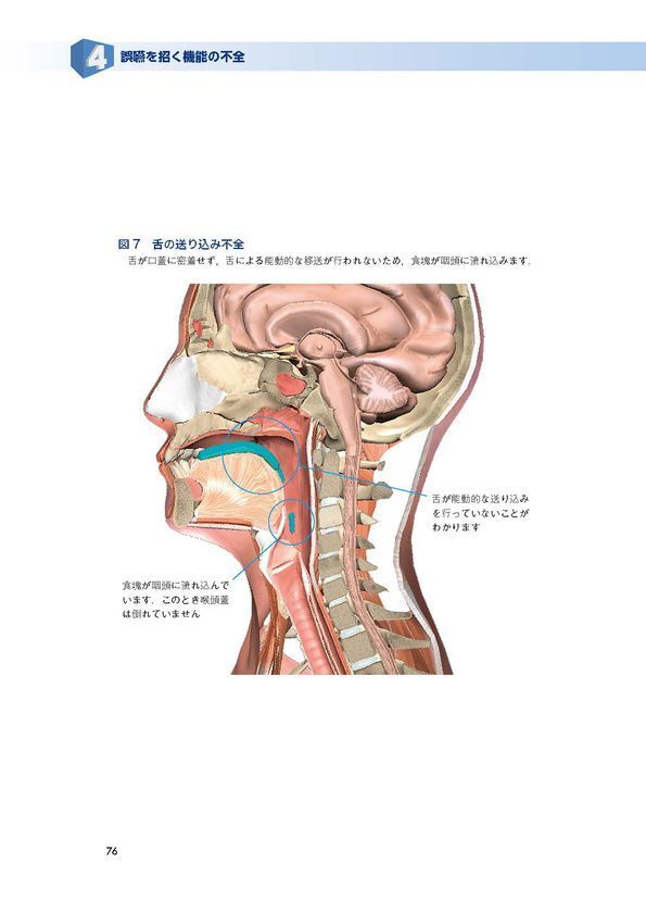 3次元CGアニメーションで立体的に学習できる医療ソフトウェア教材「CGと機能模型でわかる！」シリーズ2作が1つになってリニューアル！「新版 摂食嚥下と誤嚥のメカニズム デジタルコンテンツDL付 嚥下の仕組み～器官の異常まで」が販売開始