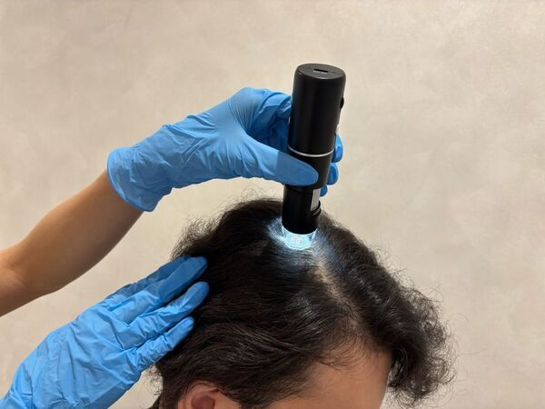 医療ダイエット専門医院「ディオクリニック」がAGA治療の診療を開始しました