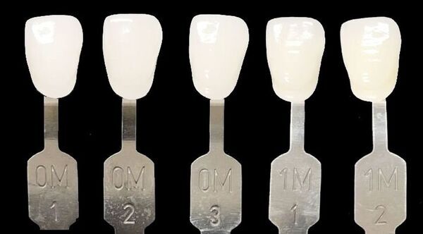 AI技術を取り入れた歯を削らない審美歯科「ルミネアーズ治療」で美しい歯と最高の笑顔を手に入れた小河麻理子さんが、世界大会でグランプリを受賞！