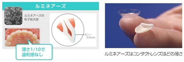 AI技術を取り入れた歯を削らない審美歯科「ルミネアーズ治療」で美しい歯と最高の笑顔を手に入れた小河麻理子さんが、世界大会でグランプリを受賞！