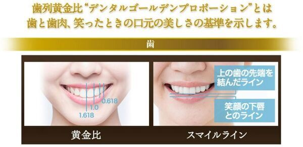 AI技術を取り入れた歯を削らない審美歯科「ルミネアーズ治療」で美しい歯と最高の笑顔を手に入れた小河麻理子さんが、世界大会でグランプリを受賞！