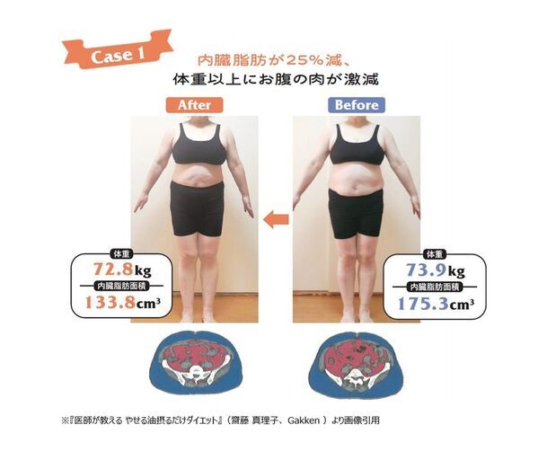 2か月で6kg減 医師の実体験から生まれた『やせる油』ダイエット　齋藤真理子医師 書籍発刊記念インタビューを公開