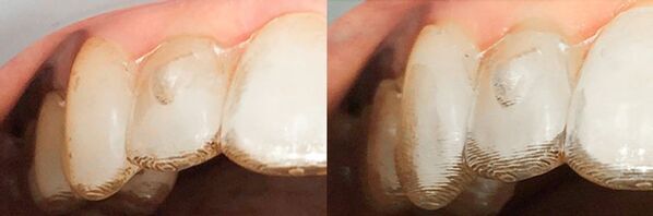 大阪矯正歯科グループ、AIで“通院いらず”の矯正治療を実現！　忙しい人でも快適・効率的に歯並び改善が可能に