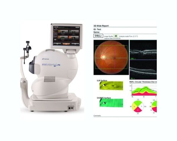 令和7年12月1日(月)より緑内障検診開始します。