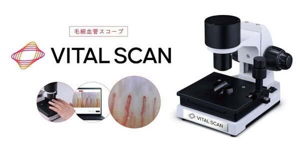 血行に着目した健康意識向上の取り組み　毛細血管スコープ「VITAL SCAN(バイタルスキャン)」販売開始