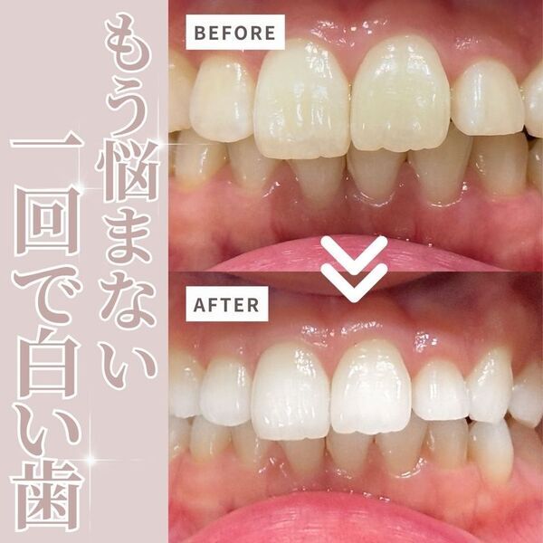 ホワイトニング市場が急成長する中、専門歯科医師が最新理論を体系化した決定版を出版