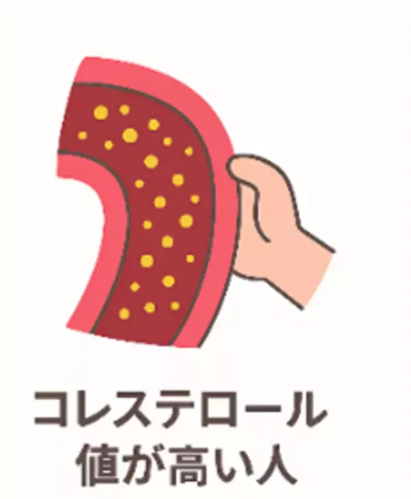 心筋梗塞の死亡者数は冬に急増！寒い冬の朝は“魔の時間帯”　“朝の血圧急上昇＝モーニングサージ”に要注意　取材内容公開～専門家が予防策を解説　キーワードは「ダッシュ体操」「靴下」、そして「アマニ油」～