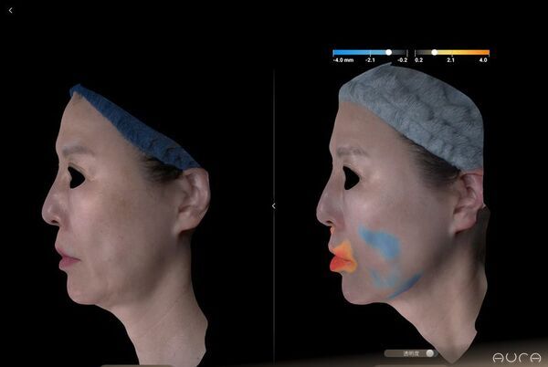 美容外科医・アーティストNobu Suetakeが「3D Skin Data Art Project」を開始