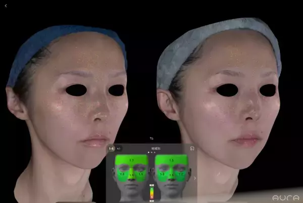 美容外科医・アーティストNobu Suetakeが「3D Skin Data Art Project」を開始