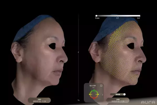美容外科医・アーティストNobu Suetakeが「3D Skin Data Art Project」を開始
