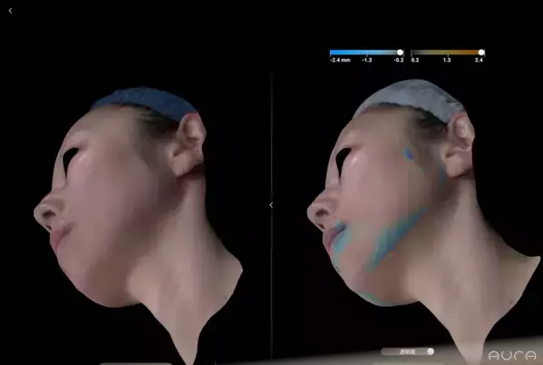 美容外科医・アーティストNobu Suetakeが「3D Skin Data Art Project」を開始