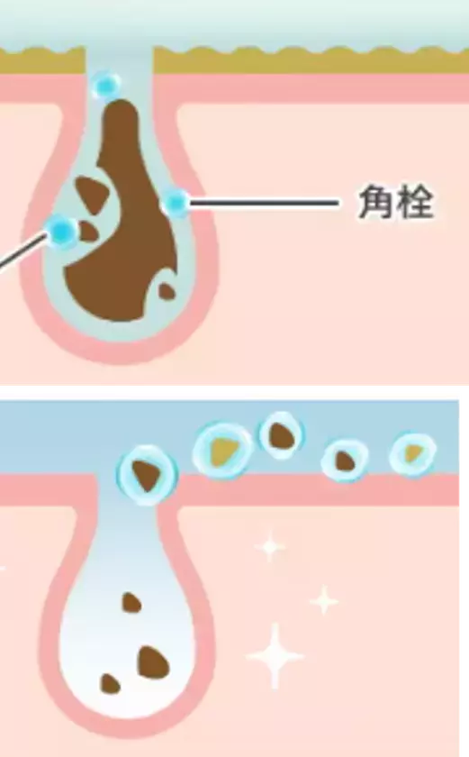 毎日のクレンジングで毛穴角栓落として、繰り返さない　パーフェクトワンフォーカス　スムースクレンジングバーム　バージョンアップしてリニューアル！2026年3月1日先行発売(本発売4月1日)