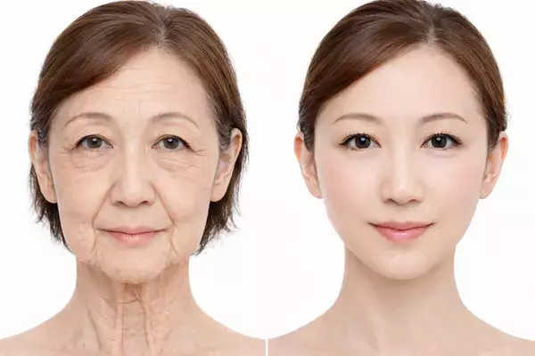 東海地方初導入　名古屋・栄で進化するたるみ治療　まゆりなclinic名古屋栄、次世代高周波治療器「ATTIVA(アッティバ)導入」