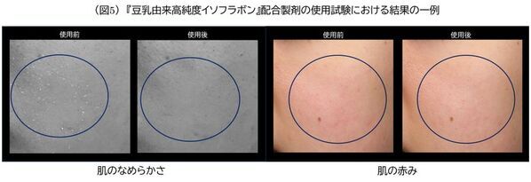 ノエビアグループ、九州産丸大豆「ふくゆたか」の『豆乳由来高純度イソフラボン』が肌のバリア機能を強化することを解明