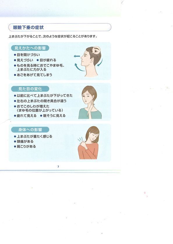 医療法人社団 岡田クリニック 眼科・緑内障・糖尿病、アップニークミニ点眼液による「眼瞼下垂」治療を開始