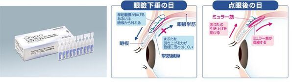 医療法人社団 岡田クリニック 眼科・緑内障・糖尿病、アップニークミニ点眼液による「眼瞼下垂」治療を開始