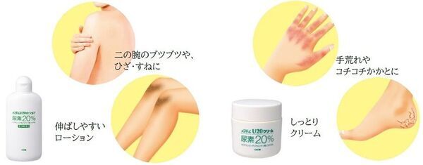 手荒れ・角化症を改善するロングセラーの「U20クリーム」から塗りのばしやすいローションタイプが新登場！『近江兄弟社メンタームU20ローション』