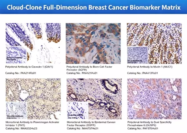 Cloud-Clone、技術革新を推進し、乳がん精密研究の将来的な発展の道筋を描く