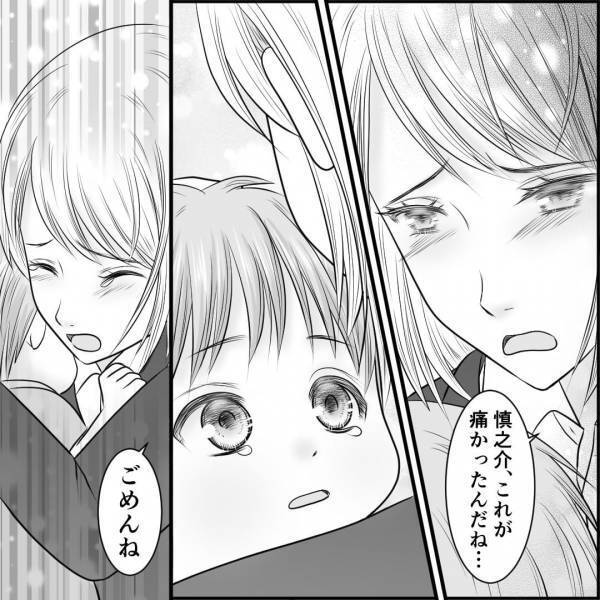 義母に”少しの間”預けると…『1歳の息子』が怪我！？異様に泣く息子を見て…⇒病院に行った結果【医者の言葉】に衝撃…