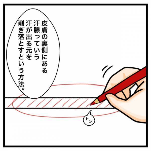 医師「君、ワキガじゃないよ」私「え？」だが次の瞬間⇒「手術…？」医師からの”恐怖の一言”で状況一変！？
