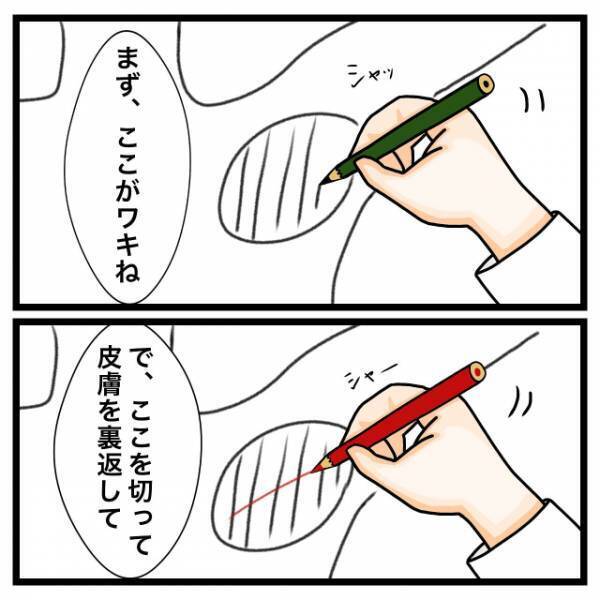 医師「君、ワキガじゃないよ」私「え？」だが次の瞬間⇒「手術…？」医師からの”恐怖の一言”で状況一変！？