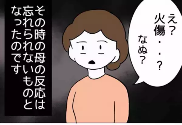 娘「”やけど”して熱出た。病院…」母「はぁ…？気のせいじゃない？」直後⇒母の【恐怖発言】に青ざめる…