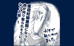 重症妊娠悪阻になった時の話