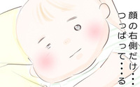 生後3ヶ月の息子が小児顔面麻痺に