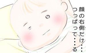 生後3ヶ月の息子が小児顔面麻痺に